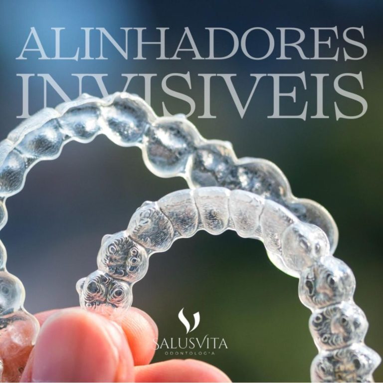 Posocionamento dos dentes