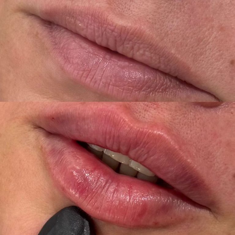 sedação consciente (1)